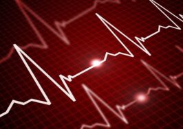 آریتمی قلبی