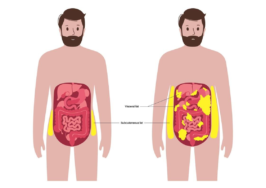 اگر شکم‌تان بزرگ‌تر شده، قلب‌تان هم در خطر است؟ ؛ راز تازه سلامت قلب در اندازه دور کمر شماست