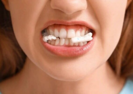 آدامس بدون قند هم خطرناک است؟؛ خطر مصرف زایلیتول برای قلب