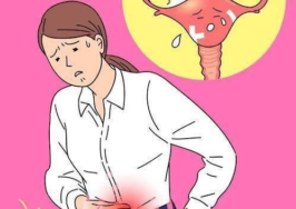 فیبروم رحم از صفر تا صد؛ فیبروم دقیقاً چیست؟ | برای درمان فیبروم رحم چه باید کرد؟ | آیا داشتن فیبروم به معنی ناباروری است؟