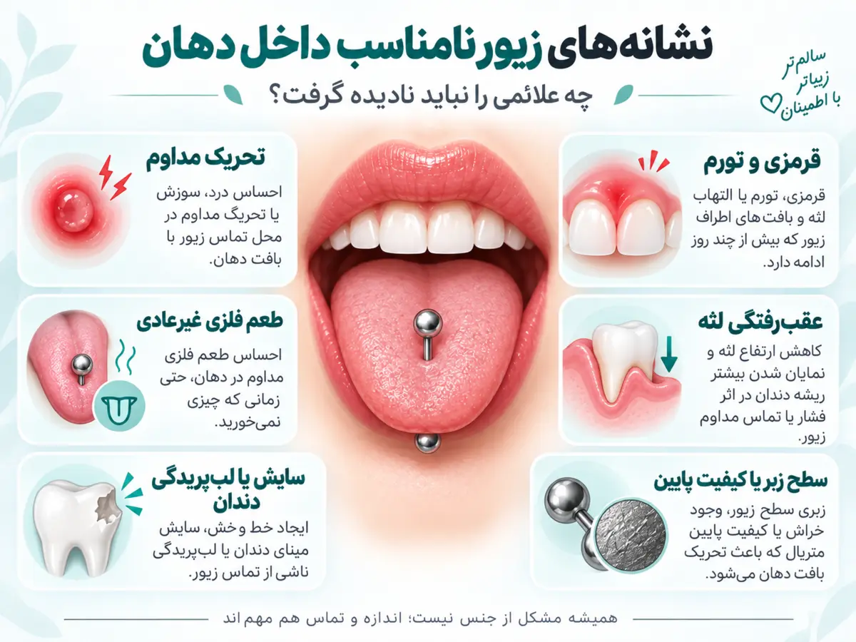 اینفوگرافیک نشانه‌های زیور نامناسب داخل دهان شامل تحریک، تورم، طعم فلزی و آسیب لثه و دندان