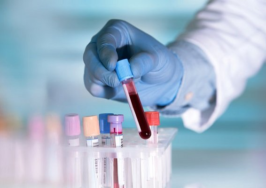 خطر HPV کاملا جدی است؛ نگرانی یک ویروس شناس